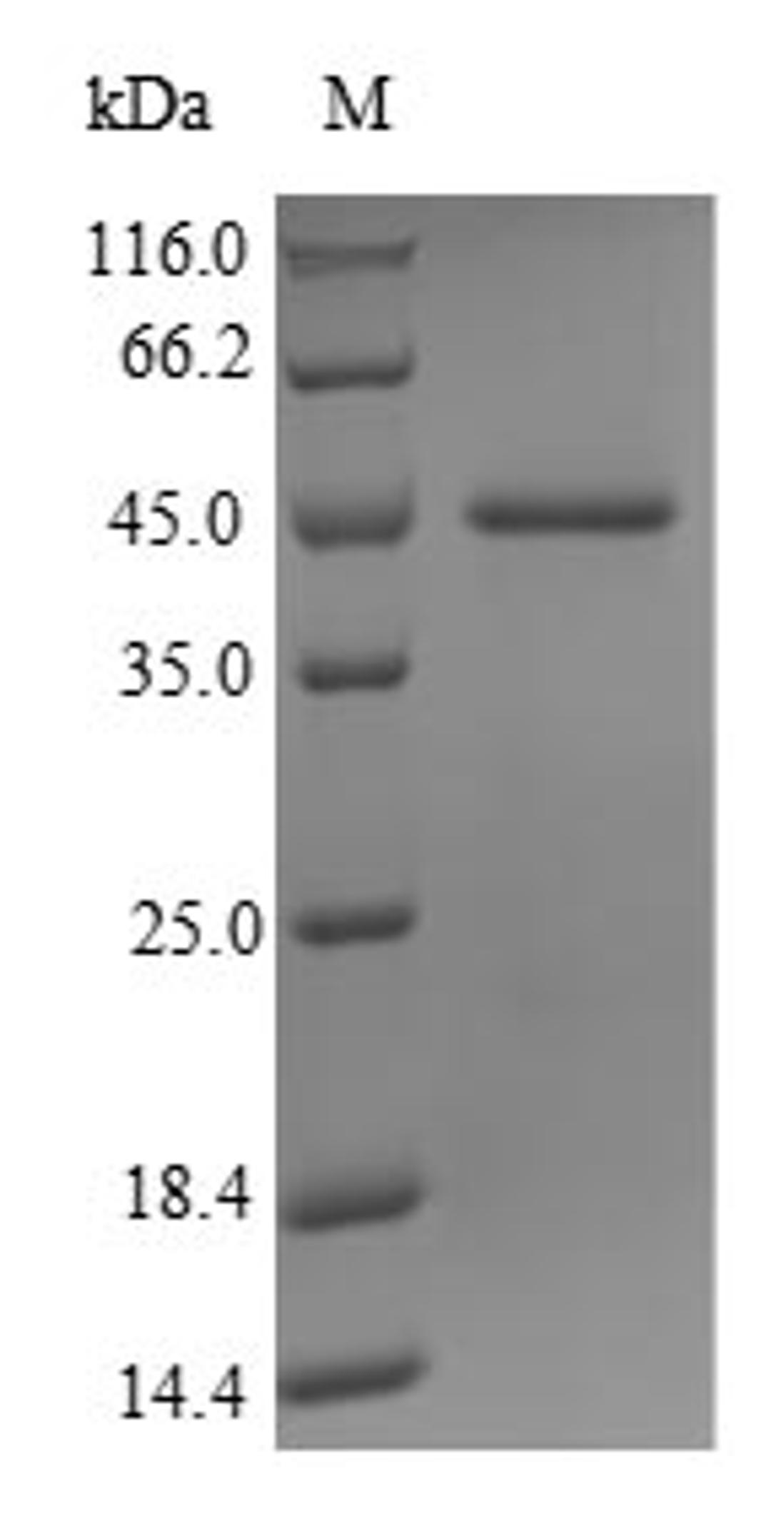 (Tris-Glycine gel) Discontinuous SDS-PAGE (reduced) with 5% enrichment gel and 15% separation gel.