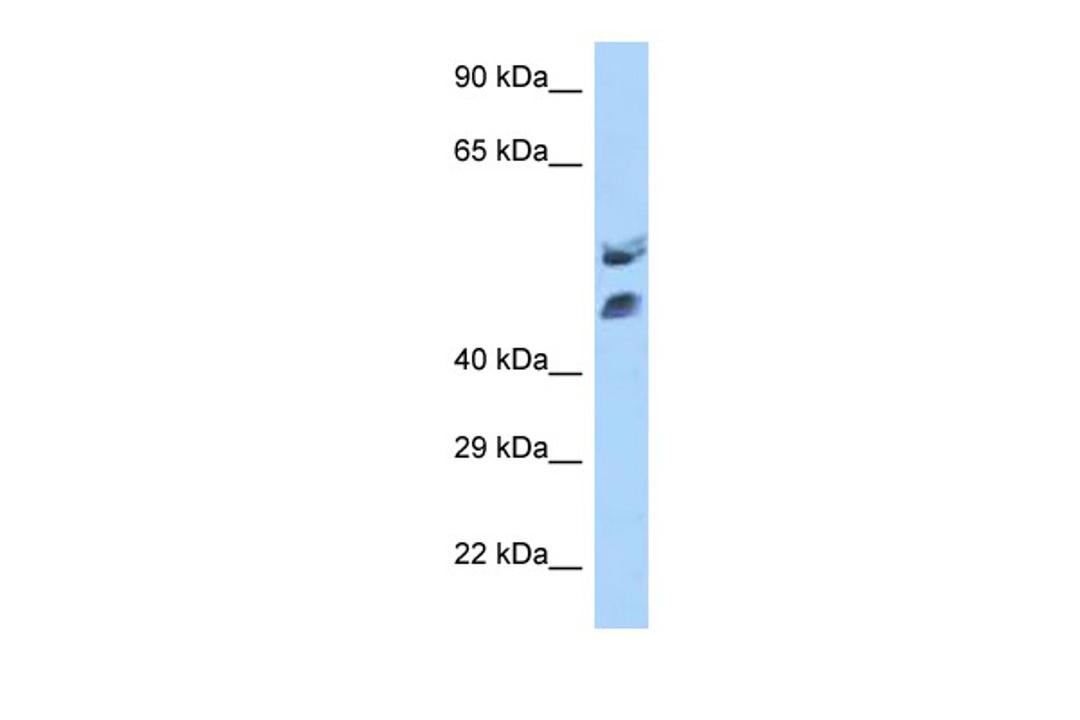 Antibody used in WB on Human Jurkat 0.2-1 ug/ml.