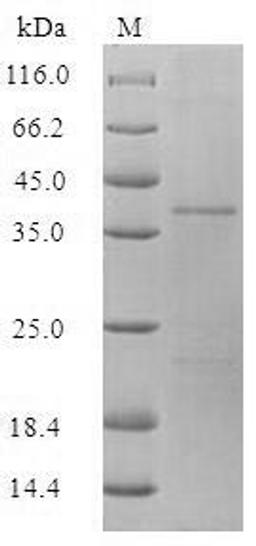 (Tris-Glycine gel) Discontinuous SDS-PAGE (reduced) with 5% enrichment gel and 15% separation gel.