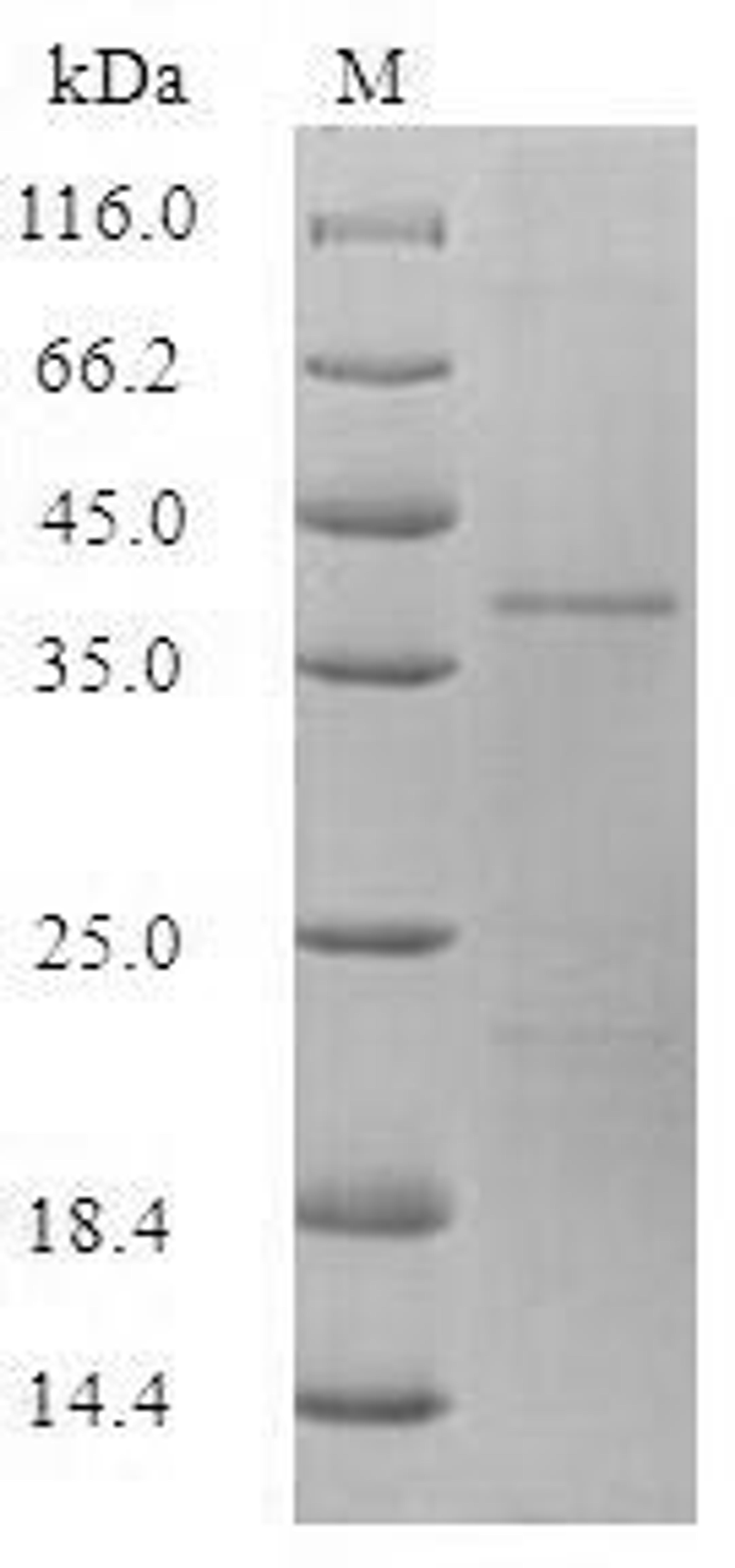 (Tris-Glycine gel) Discontinuous SDS-PAGE (reduced) with 5% enrichment gel and 15% separation gel.