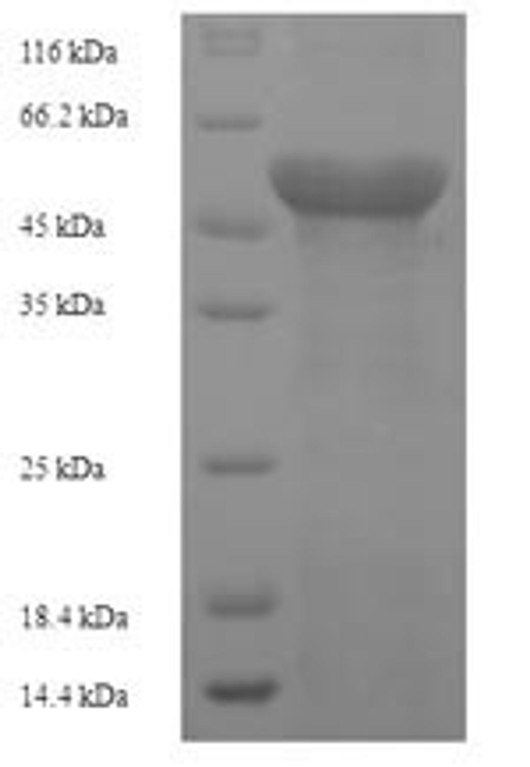 (Tris-Glycine gel) Discontinuous SDS-PAGE (reduced) with 5% enrichment gel and 15% separation gel.