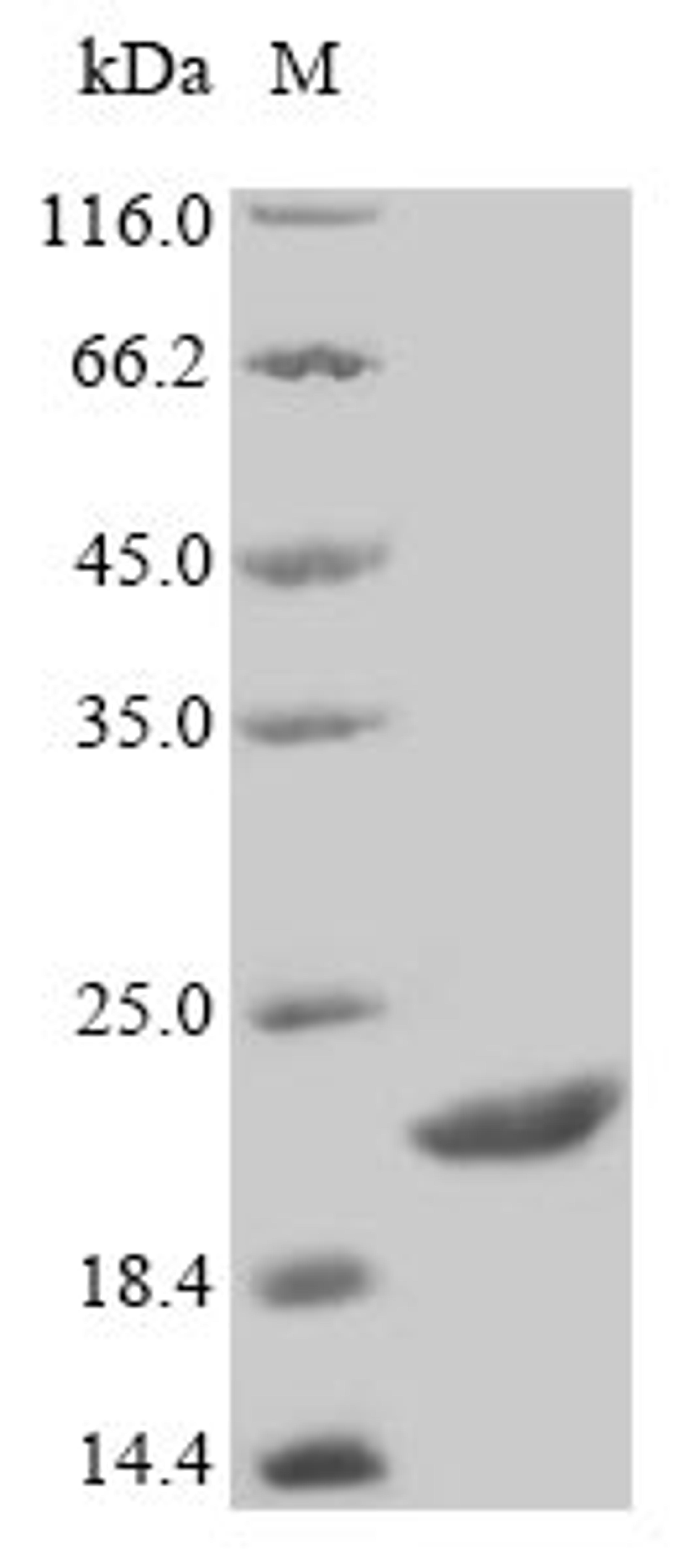(Tris-Glycine gel) Discontinuous SDS-PAGE (reduced) with 5% enrichment gel and 15% separation gel.