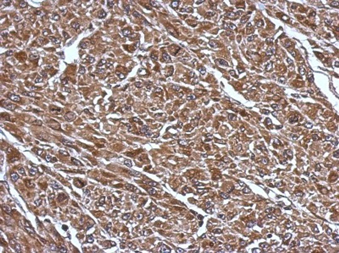 Immunohistochemistry-Paraffin: RABGGTB Antibody [NBP2-20048] - Immunohistochemical analysis of paraffin-embedded U87 xenograft, using antibody at 1:500 dilution.