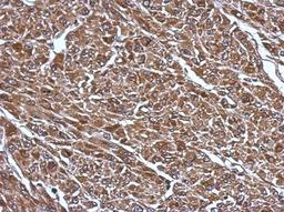 Immunohistochemistry-Paraffin: RABGGTB Antibody [NBP2-20048] - Immunohistochemical analysis of paraffin-embedded U87 xenograft, using antibody at 1:500 dilution.