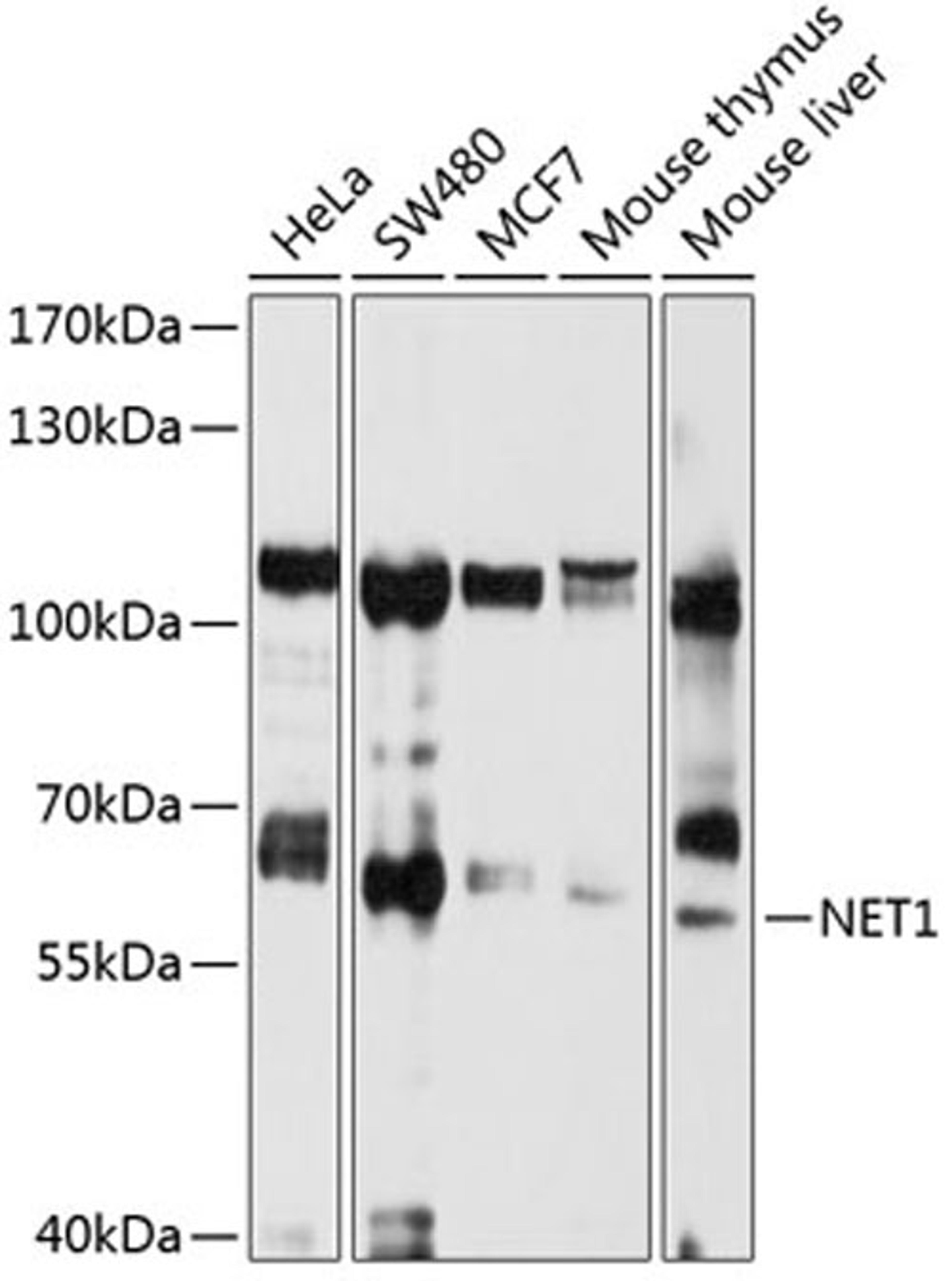 Western blot - NET1 antibody (A1213)