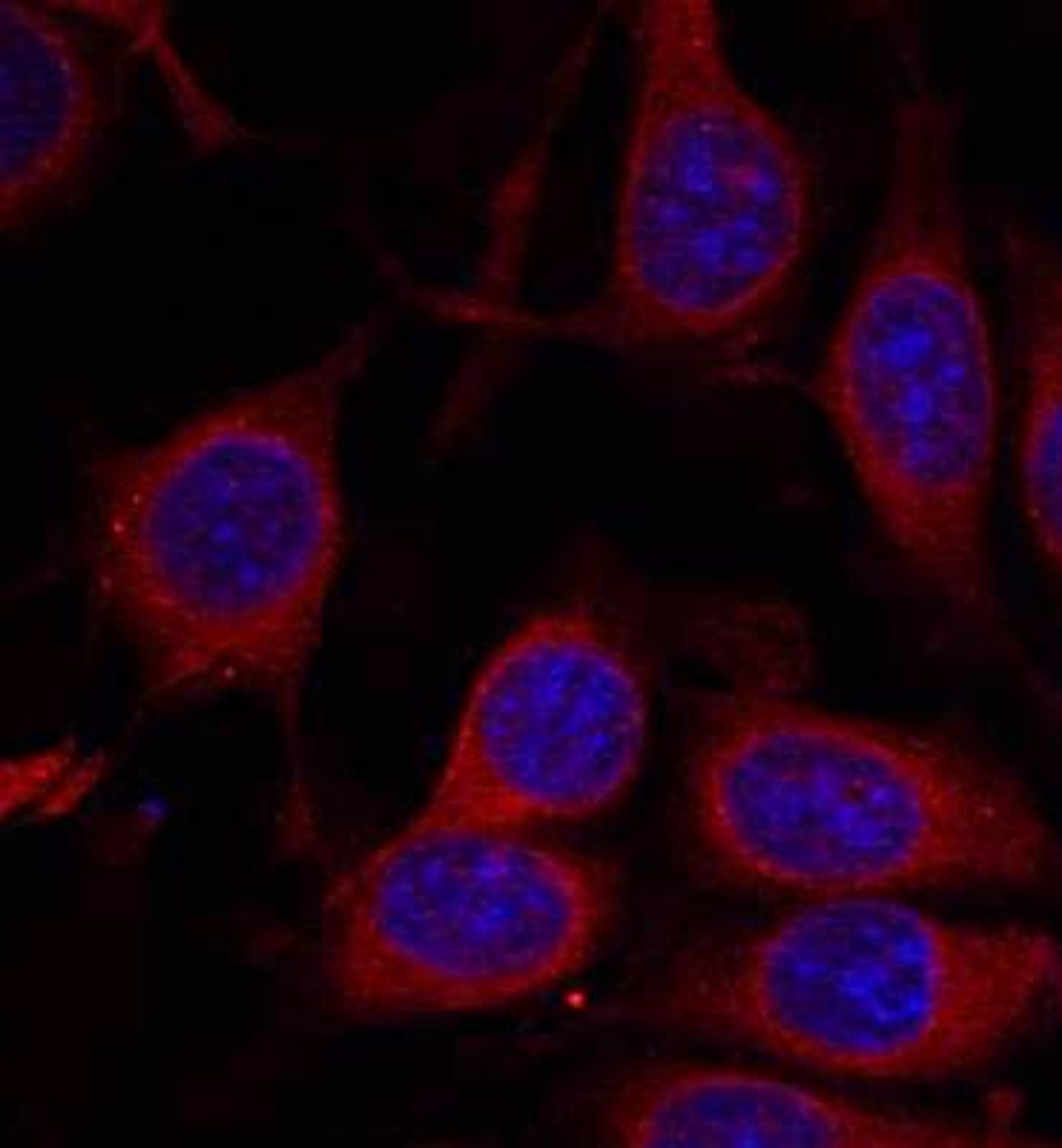 Confocal immunofluorescent analysis of MCF7 cells using mTOR(Ab-2448) antibody