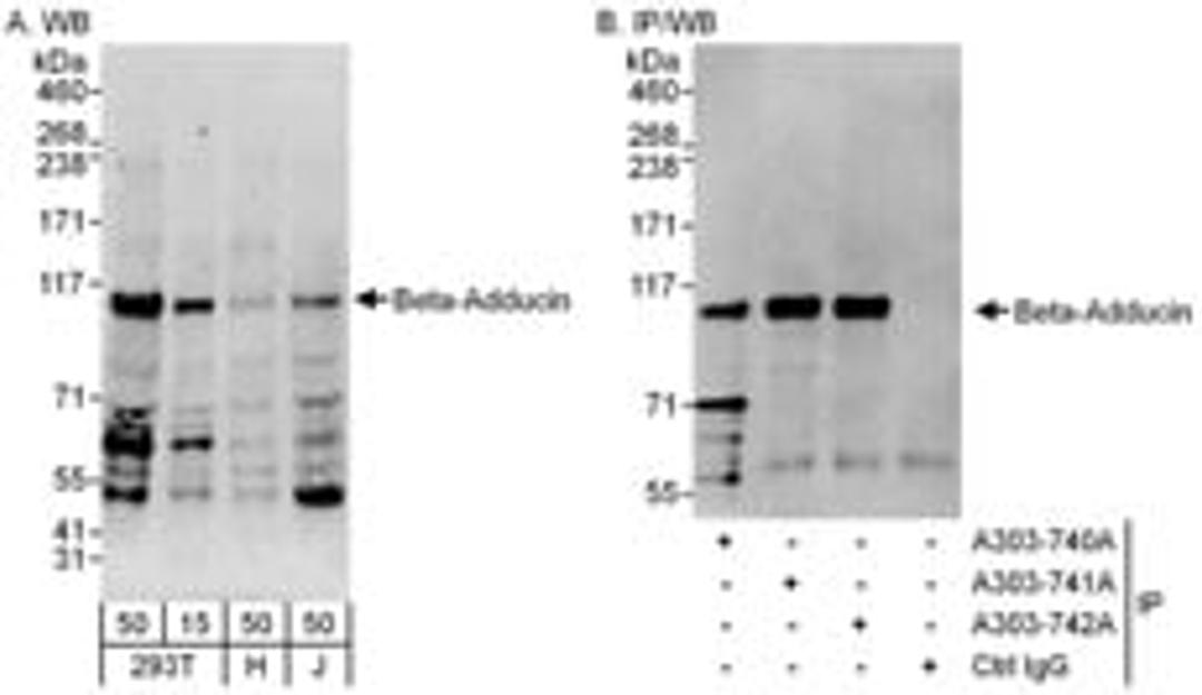 Detection of human Beta-Adducin by western blot and immunoprecipitation.