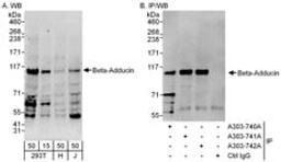 Detection of human Beta-Adducin by western blot and immunoprecipitation.