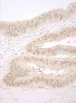 Detection of human CNOT2 by immunohistochemistry.