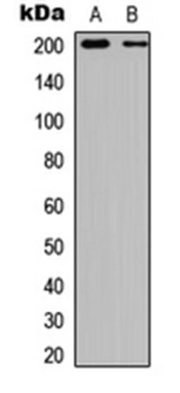 Western blot analysis of HEK293T insulin-treated (Lane 1), NIH3T3 insulin-treated (Lane 2) whole cell lysates using TSC2 (phospho-S939) antibody