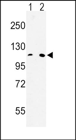 Western blot analysis of MTTP Antibody in Hela(lane 1), 293(lane 2) cell line lysates (35ug/lane)