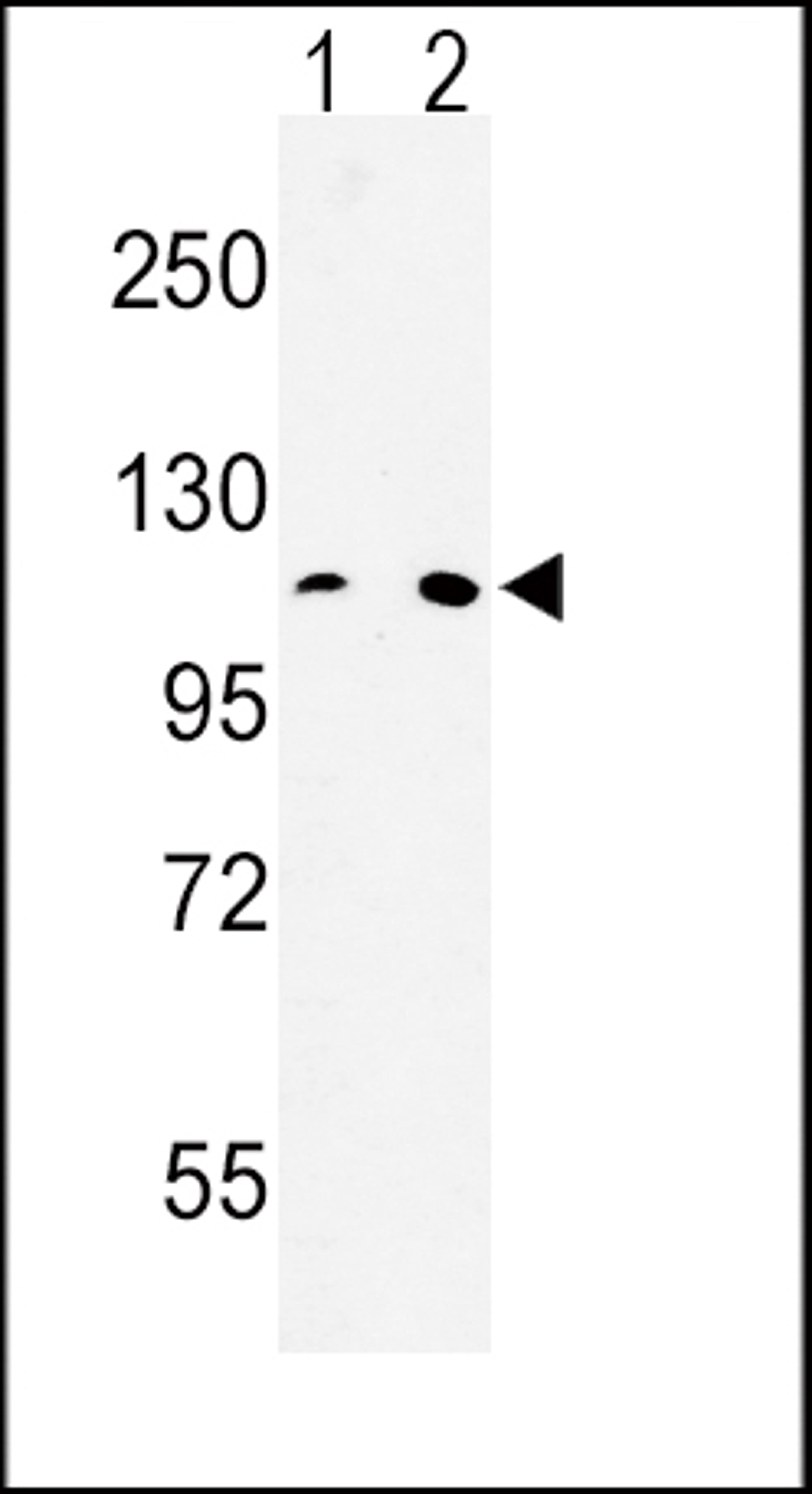 Western blot analysis of MTTP Antibody in Hela(lane 1), 293(lane 2) cell line lysates (35ug/lane)