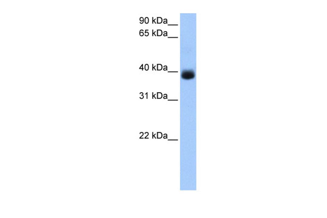 Antibody used in WB on Human Liver at 0.2-1 ug/ml.