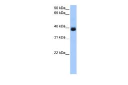 Antibody used in WB on Human Liver at 0.2-1 ug/ml.