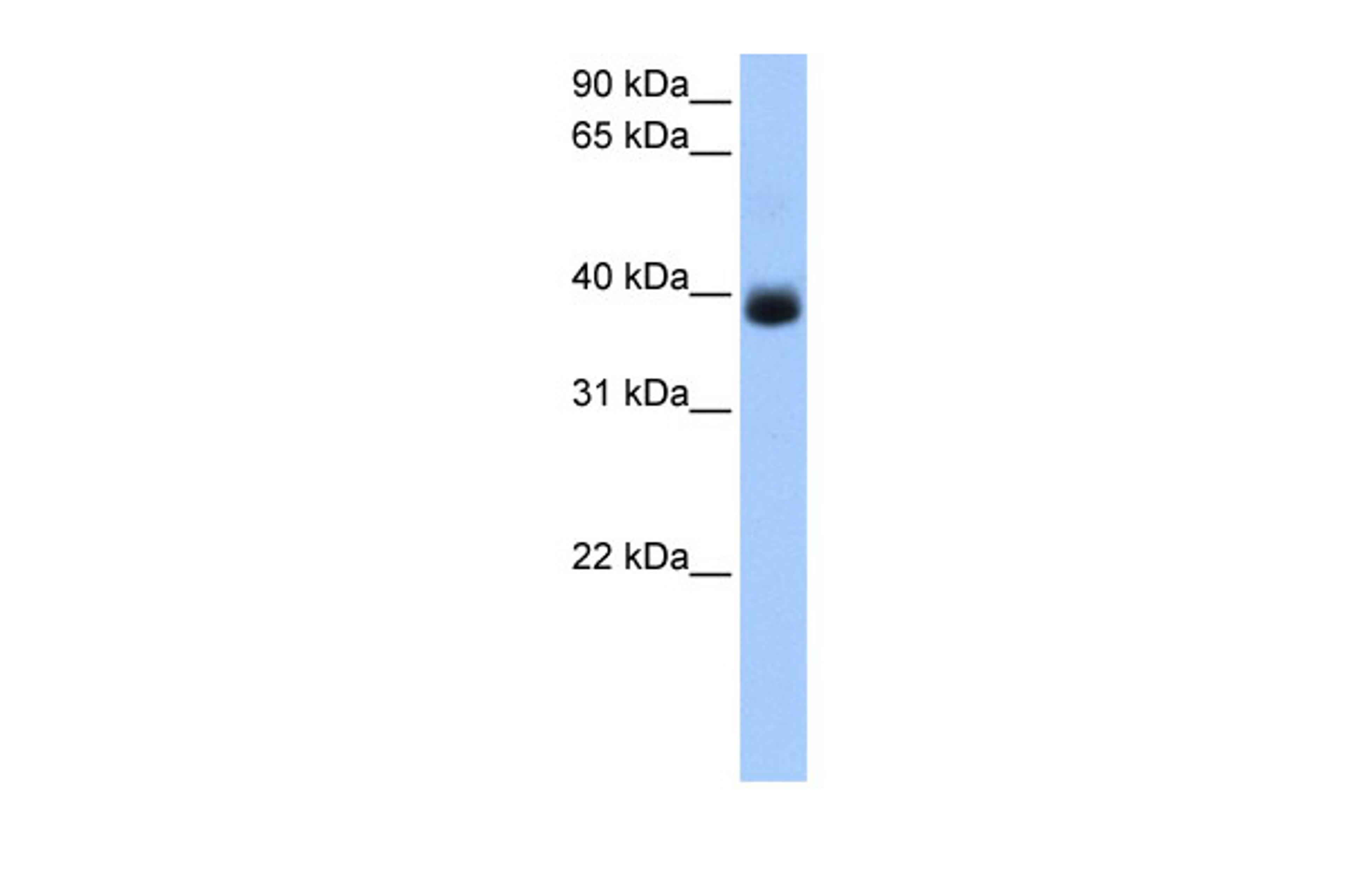 Antibody used in WB on Human Liver at 0.2-1 ug/ml.