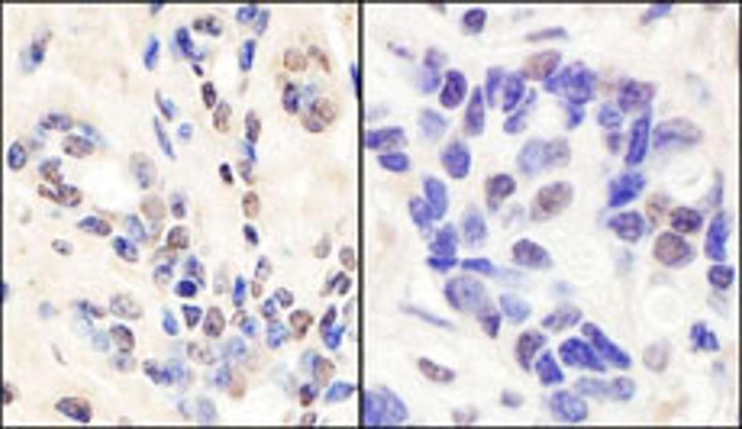 Detection of human BRCA1 by immunohistochemistry.