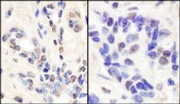 Detection of human BRCA1 by immunohistochemistry.