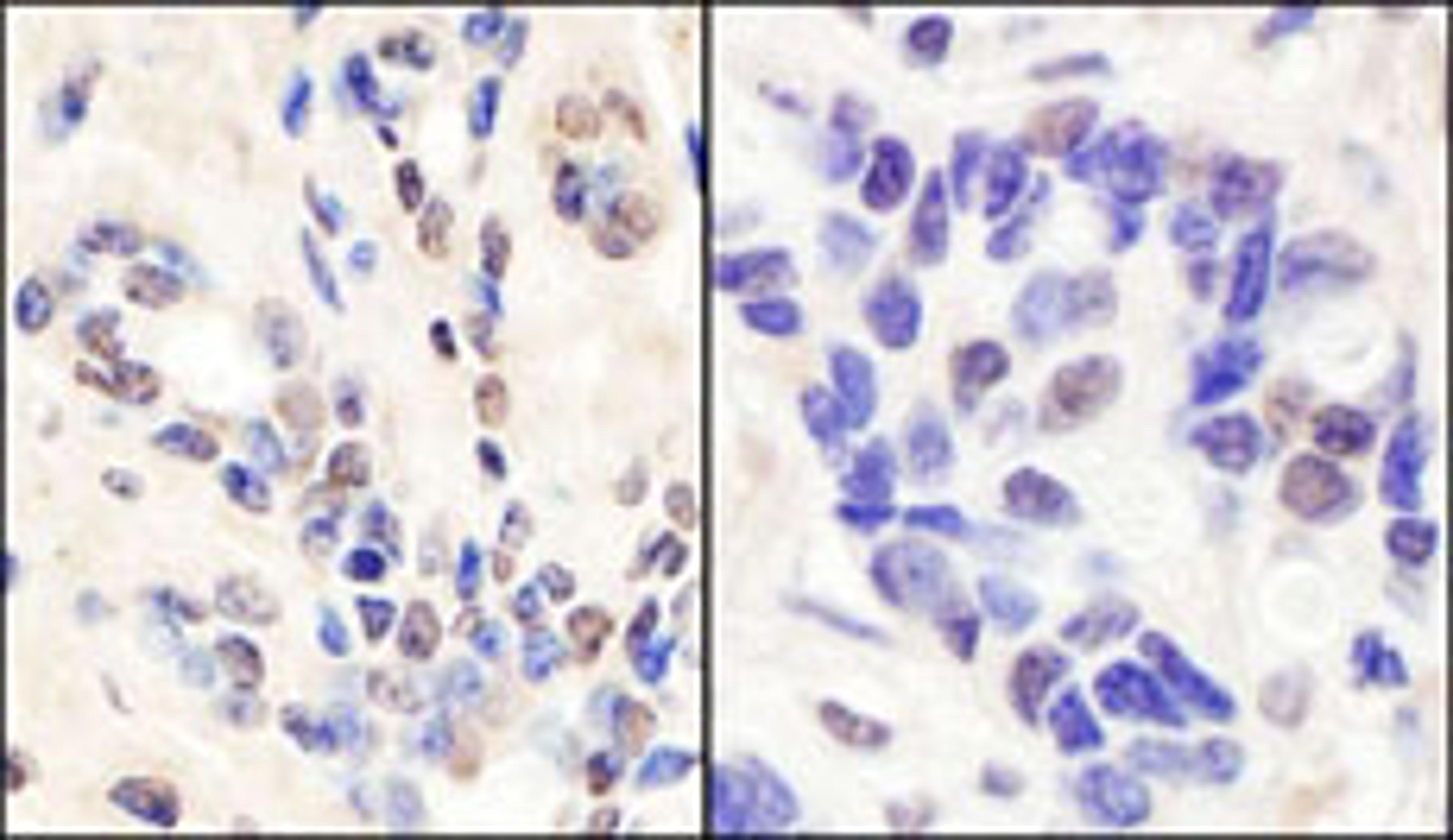 Detection of human BRCA1 by immunohistochemistry.