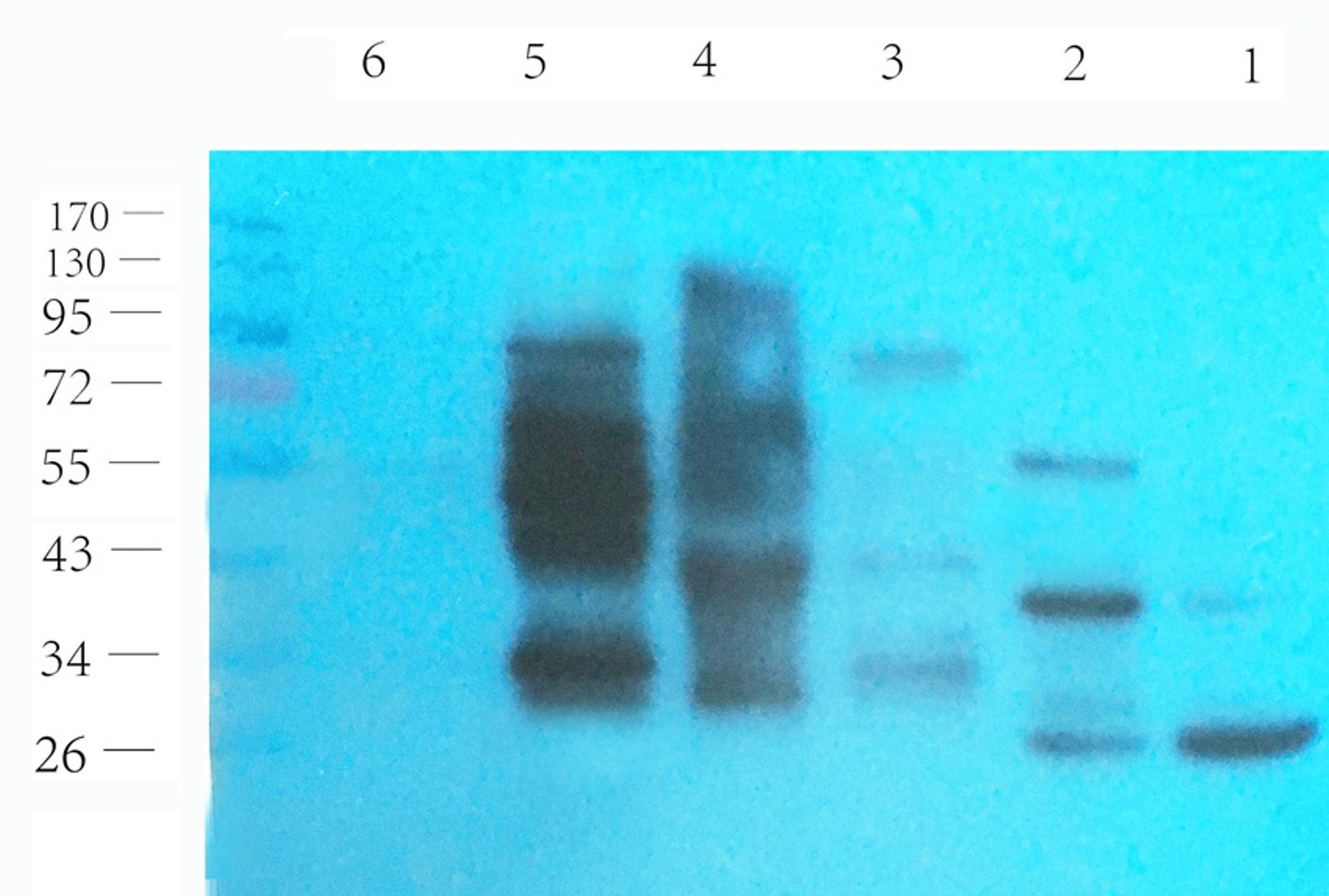 Western blot analysis of rat kidney (lane 1), rat liver (lane 2), mouse muscle (lane 3), mouse brain (lane 4), U251 cells (lane 5), Hela cells (lane 6) using SLC22A6 antibody (1 ug/ml) 