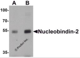 Western blot analysis of Nucleobindin-2 in rat brain tissue lysate with Nucleobindin-2 antibody at (A) 0.5 and (B) 1 &#956;g/mL.