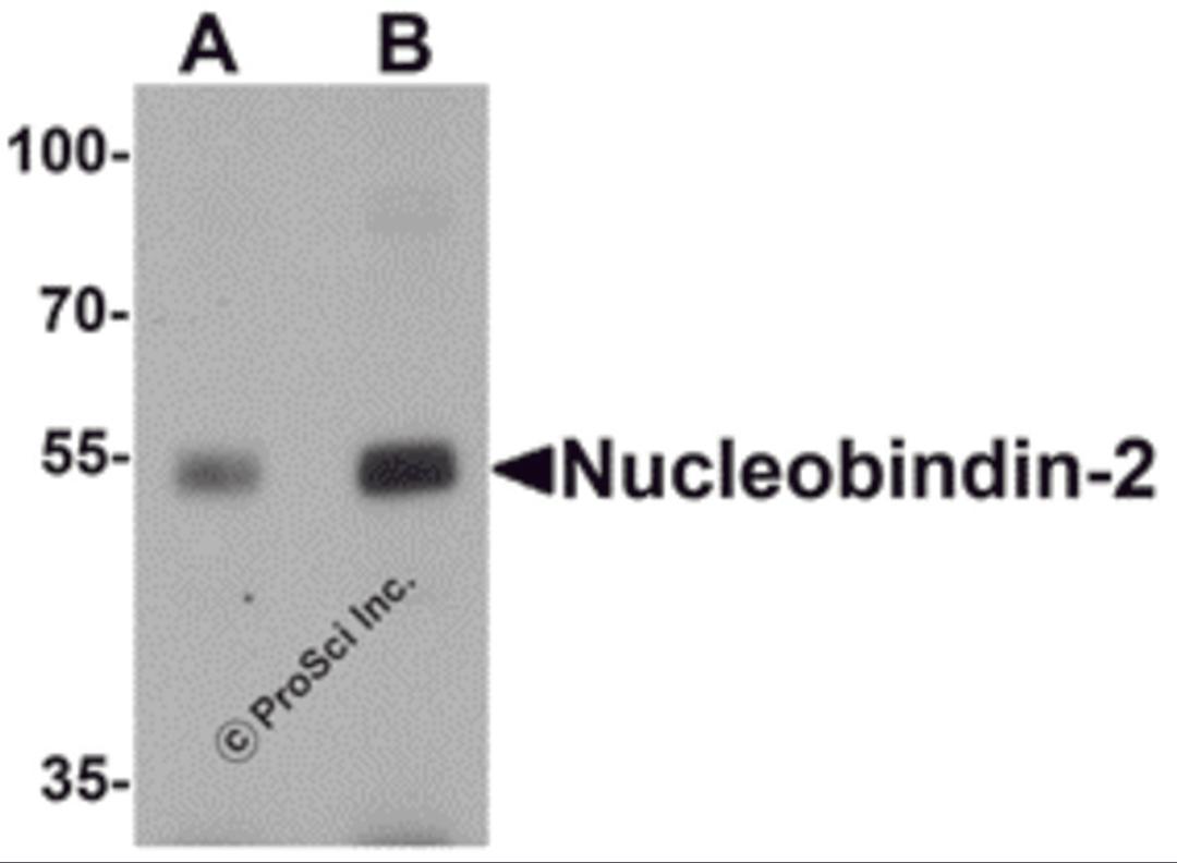 Western blot analysis of Nucleobindin-2 in rat brain tissue lysate with Nucleobindin-2 antibody at (A) 0.5 and (B) 1 μg/mL.