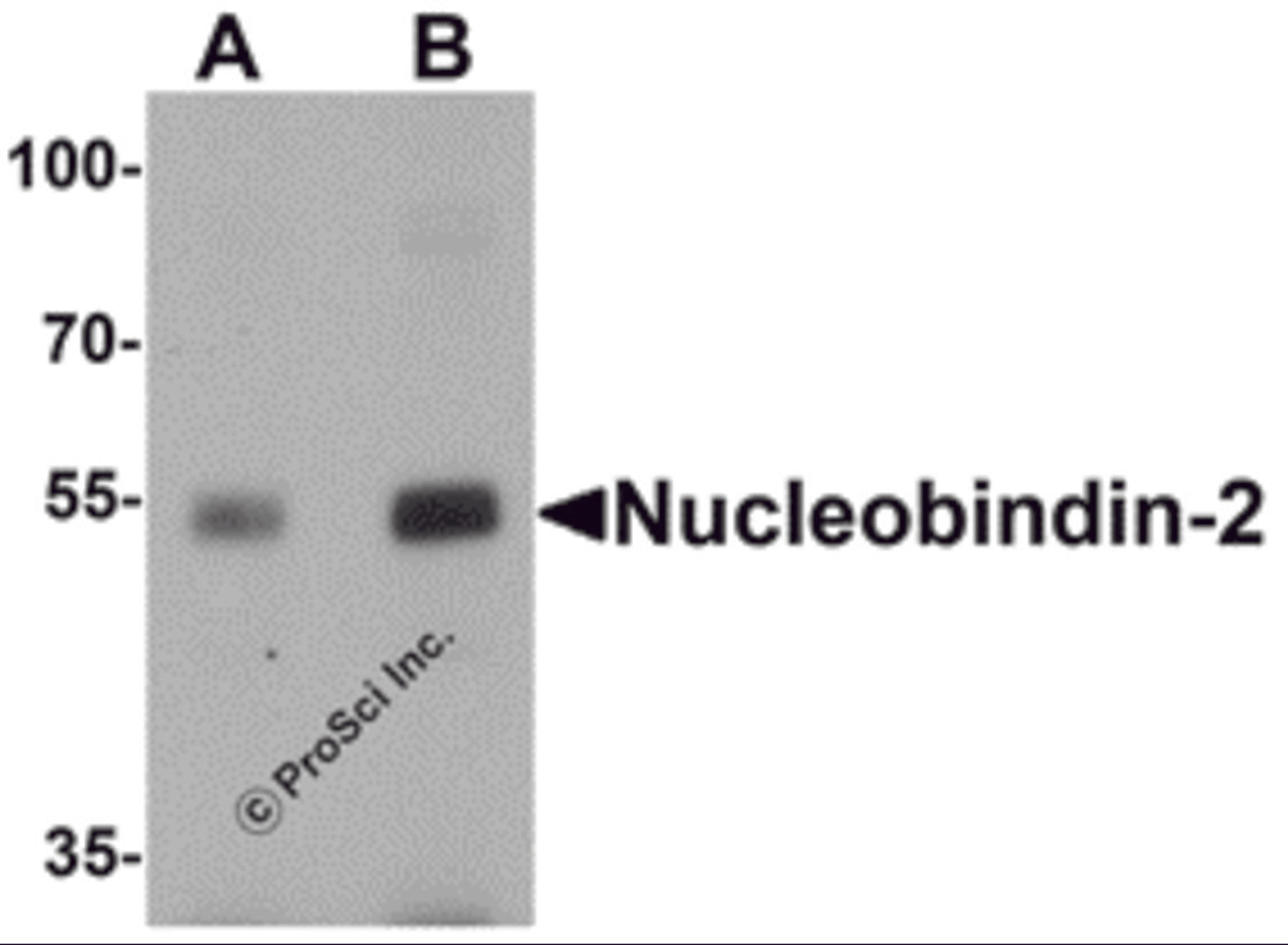 Western blot analysis of Nucleobindin-2 in rat brain tissue lysate with Nucleobindin-2 antibody at (A) 0.5 and (B) 1 μg/mL.