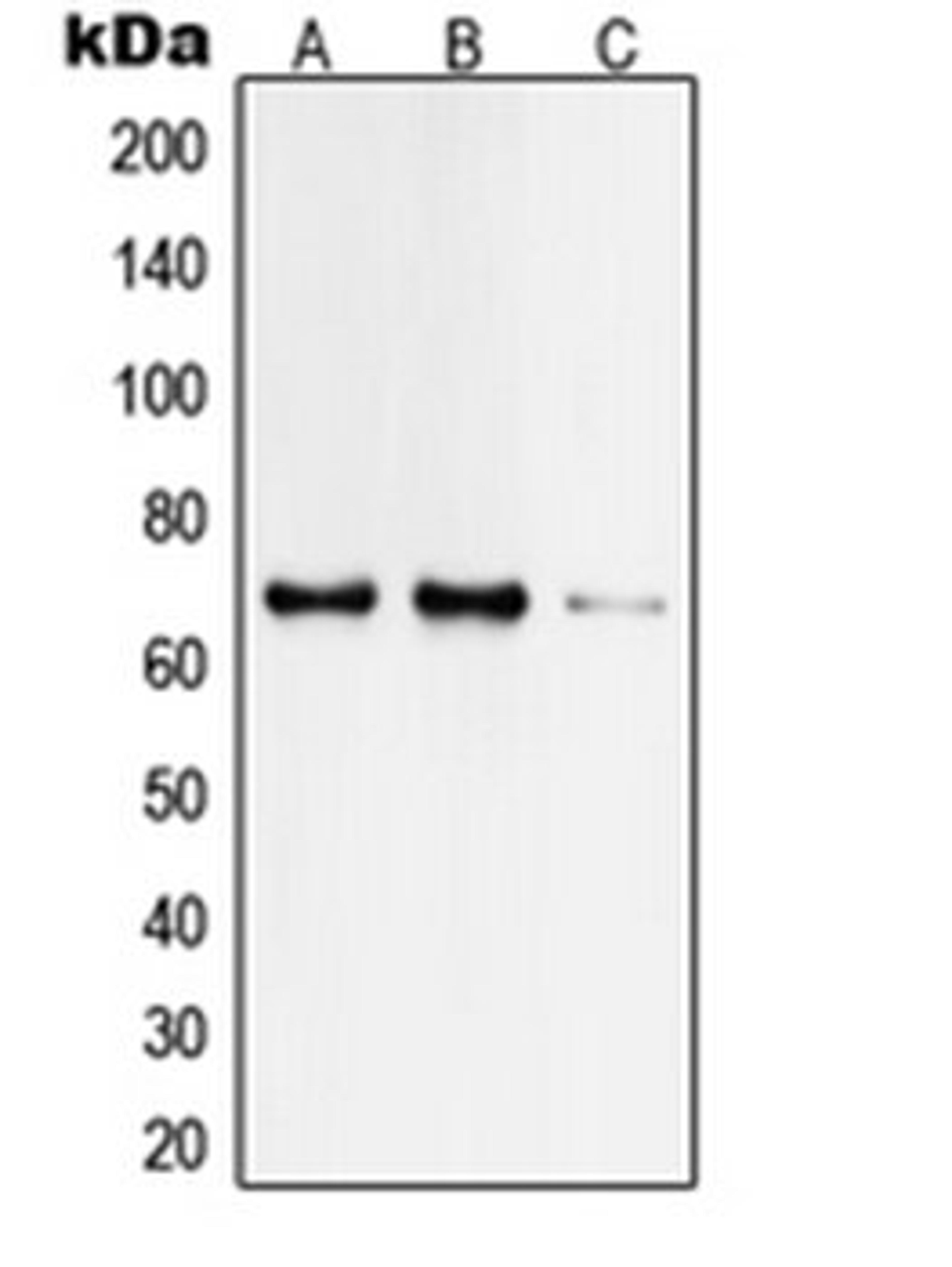 Western blot analysis of HeLa (Lane 1), Jurkat (Lane 2), rat brain (Lane 3) whole cell lysates using TAF6L antibody