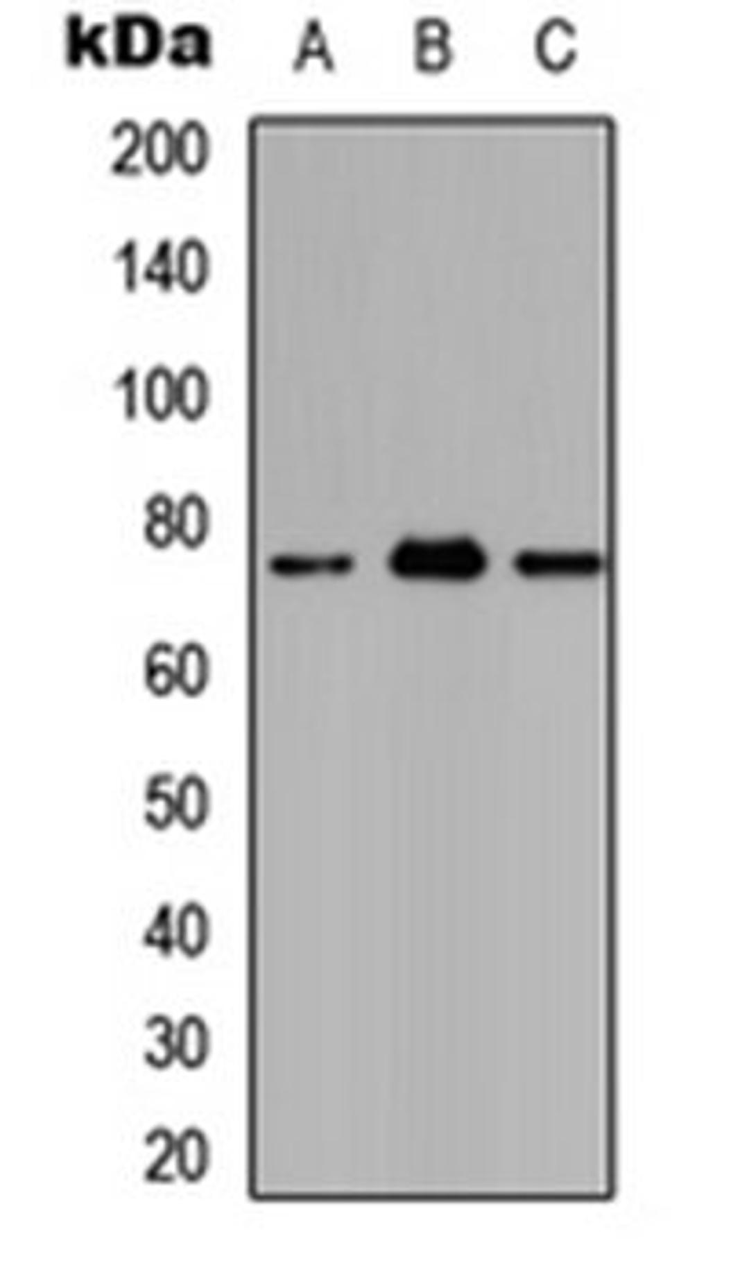 Western blot analysis of HEK293T (Lane 1), Raw264.7 (Lane 2), H9C2 (Lane 3) whole cell lysates using Ataxin 7L2 antibody