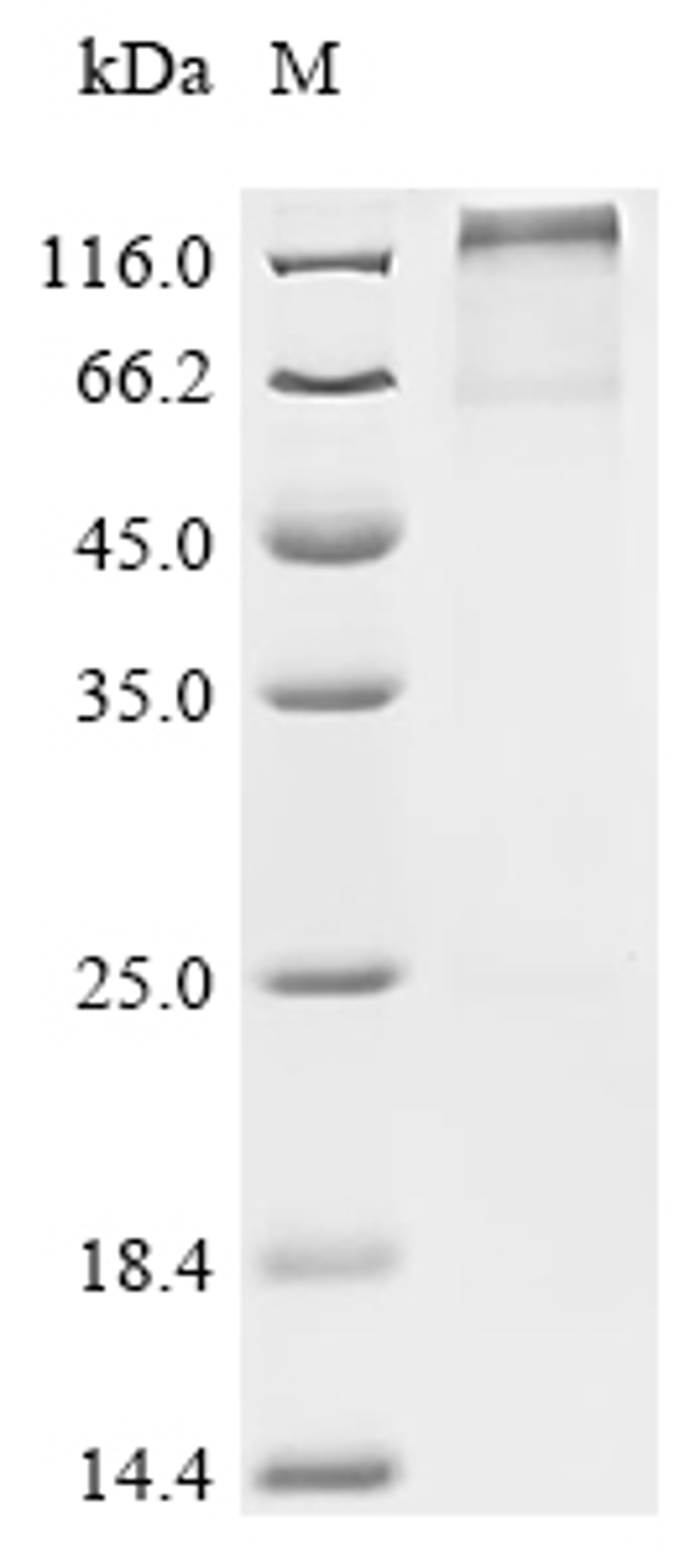 (Tris-Glycine gel) Discontinuous SDS-PAGE (reduced) with 5% enrichment gel and 15% separation gel.