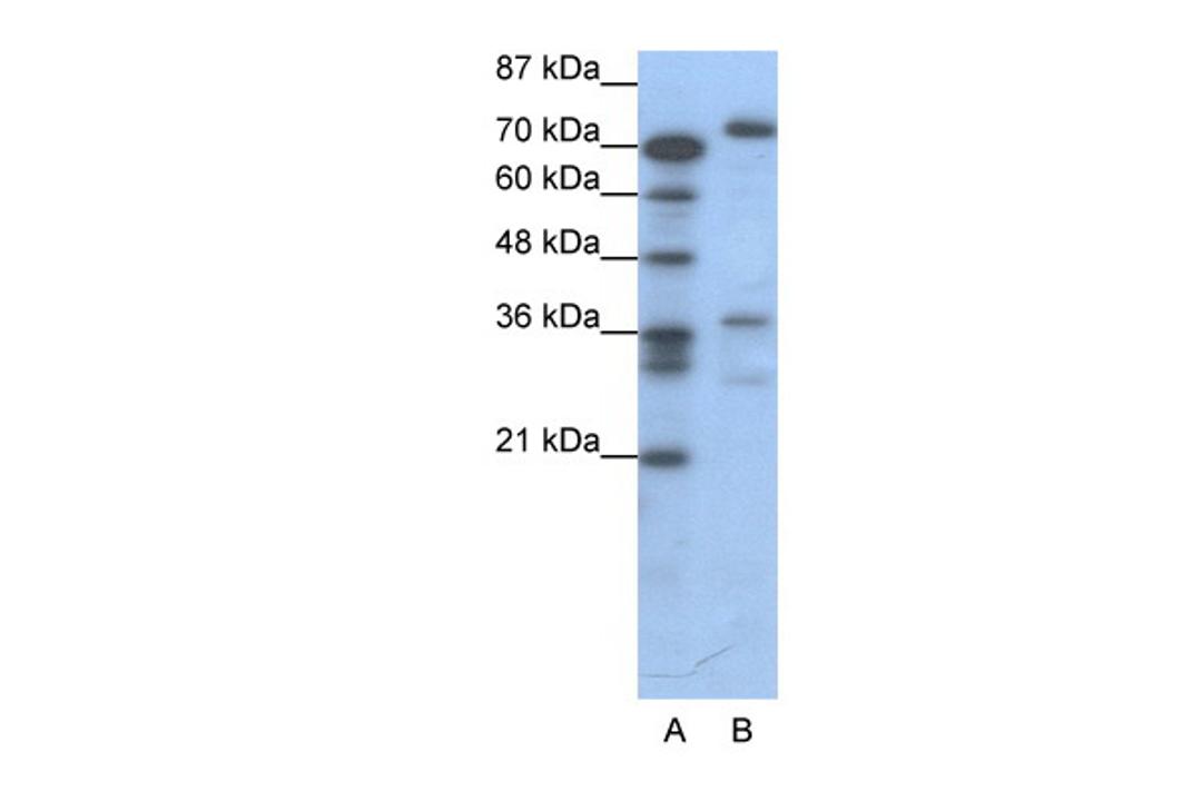 Antibody used in WB on Human Jurkat 0.2-1 ug/ml.