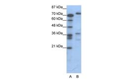 Antibody used in WB on Human Jurkat 0.2-1 ug/ml.