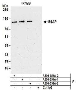 Detection of human E6AP by western blot of immunoprecipitates.