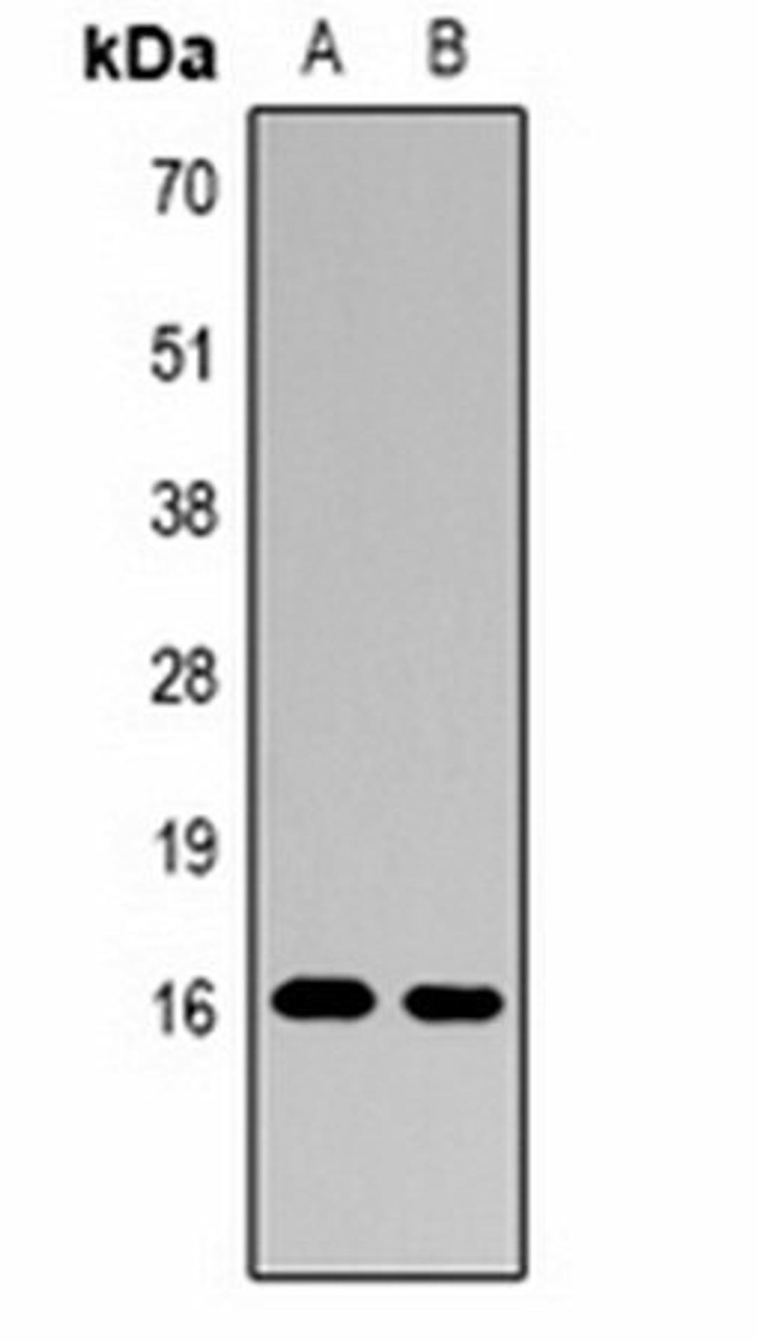 Western blot analysis of Hela (Lane1), NIH3T3 (Lane2) whole cell lysates using Histone H3 (MonoMethyl R26) antibody