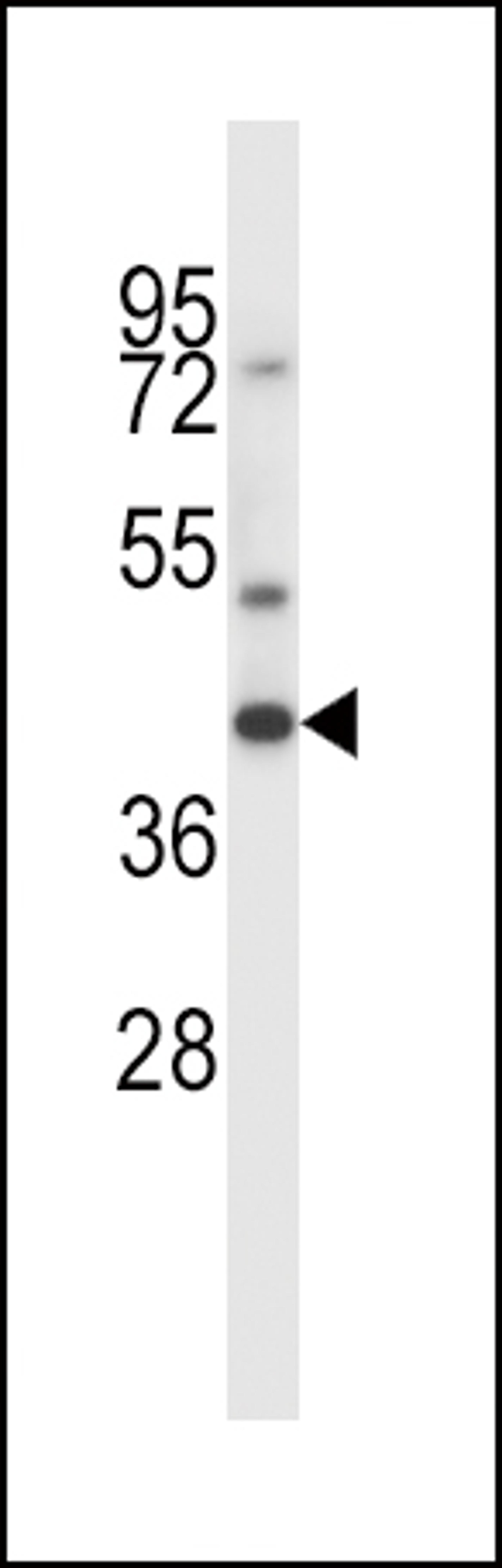 Western blot analysis in CEM cell line lysates (35ug/lane).