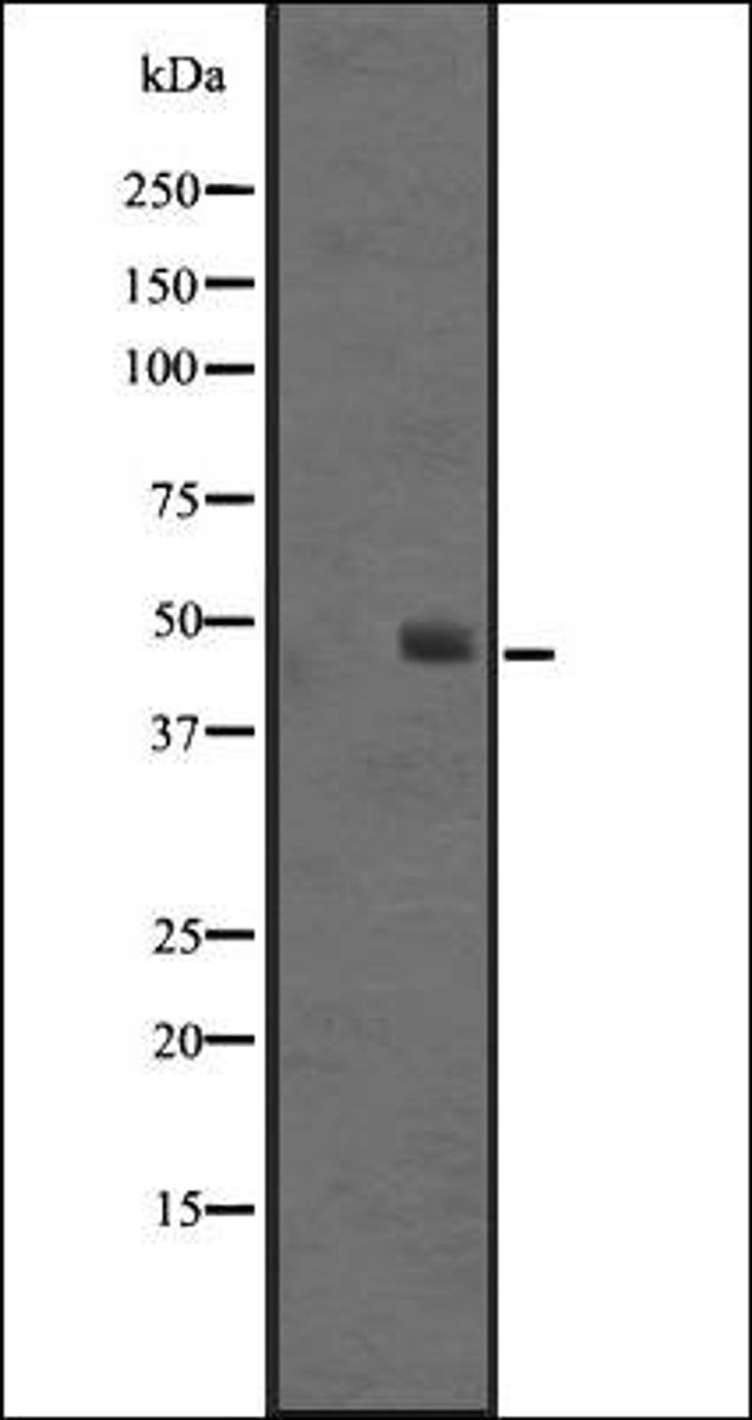 Western blot analysis of Jurkat cell lysate using SS4R antibody