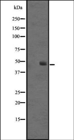 Western blot analysis of Jurkat cell lysate using SS4R antibody