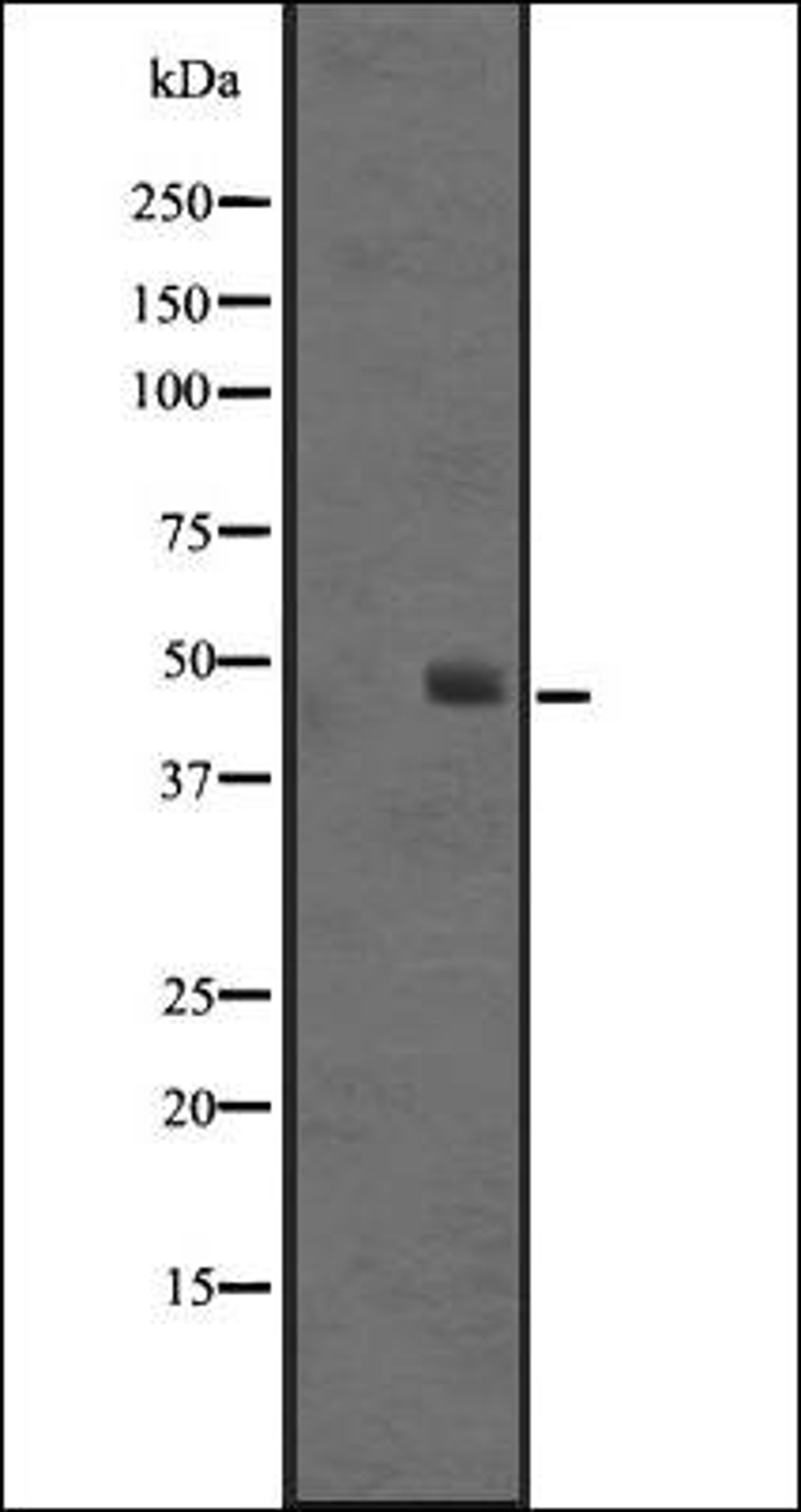 Western blot analysis of Jurkat cell lysate using SS4R antibody