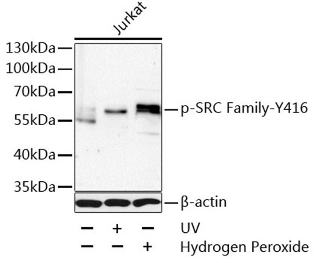 Western blot - Phospho-SRC Family-Y416 antibody (AP0491)