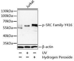 Western blot - Phospho-SRC Family-Y416 antibody (AP0491)