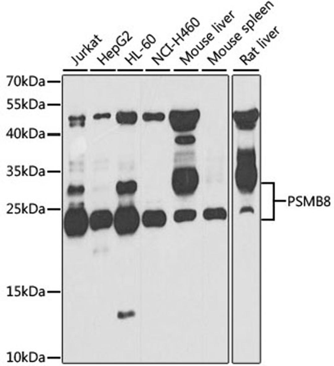 Western blot - PSMB8 antibody (A7340)