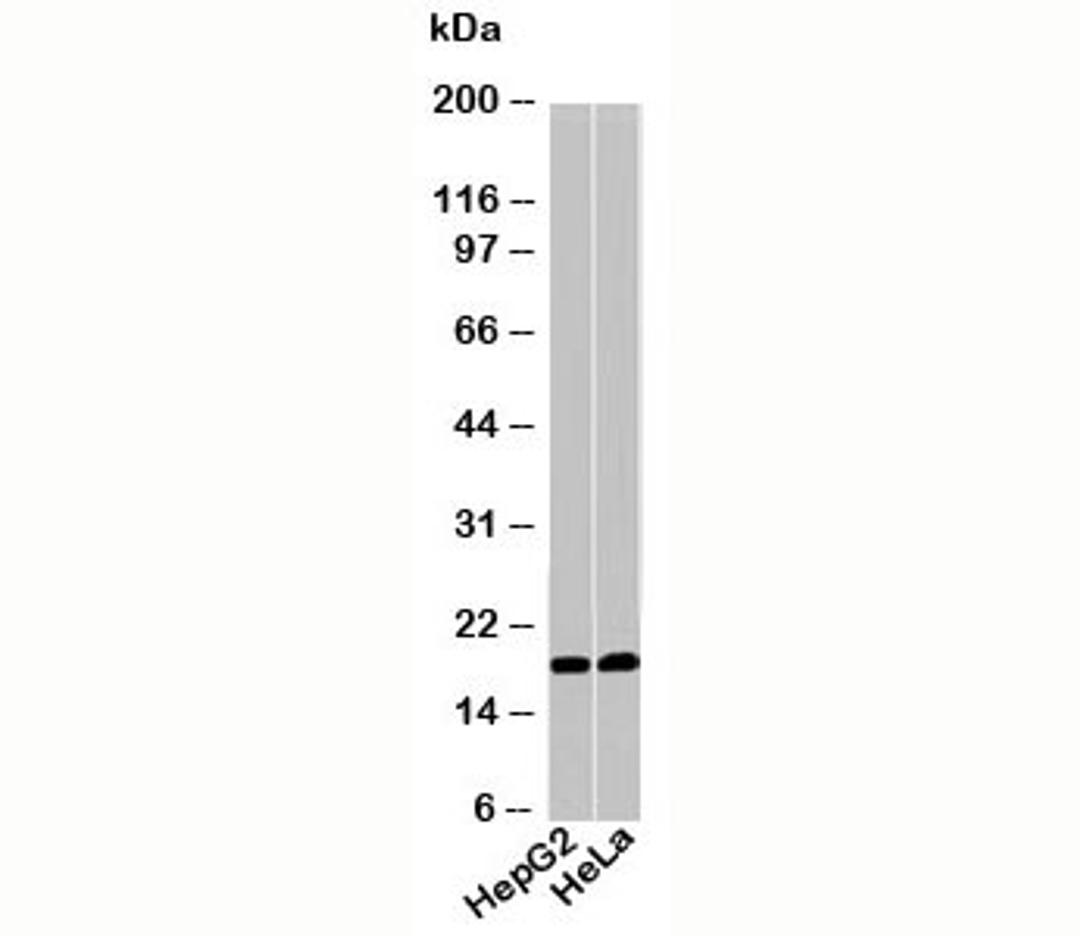 Western blot testing of human samples with Acid Phosphatase / ACP1 antibody at 1ug/ml.