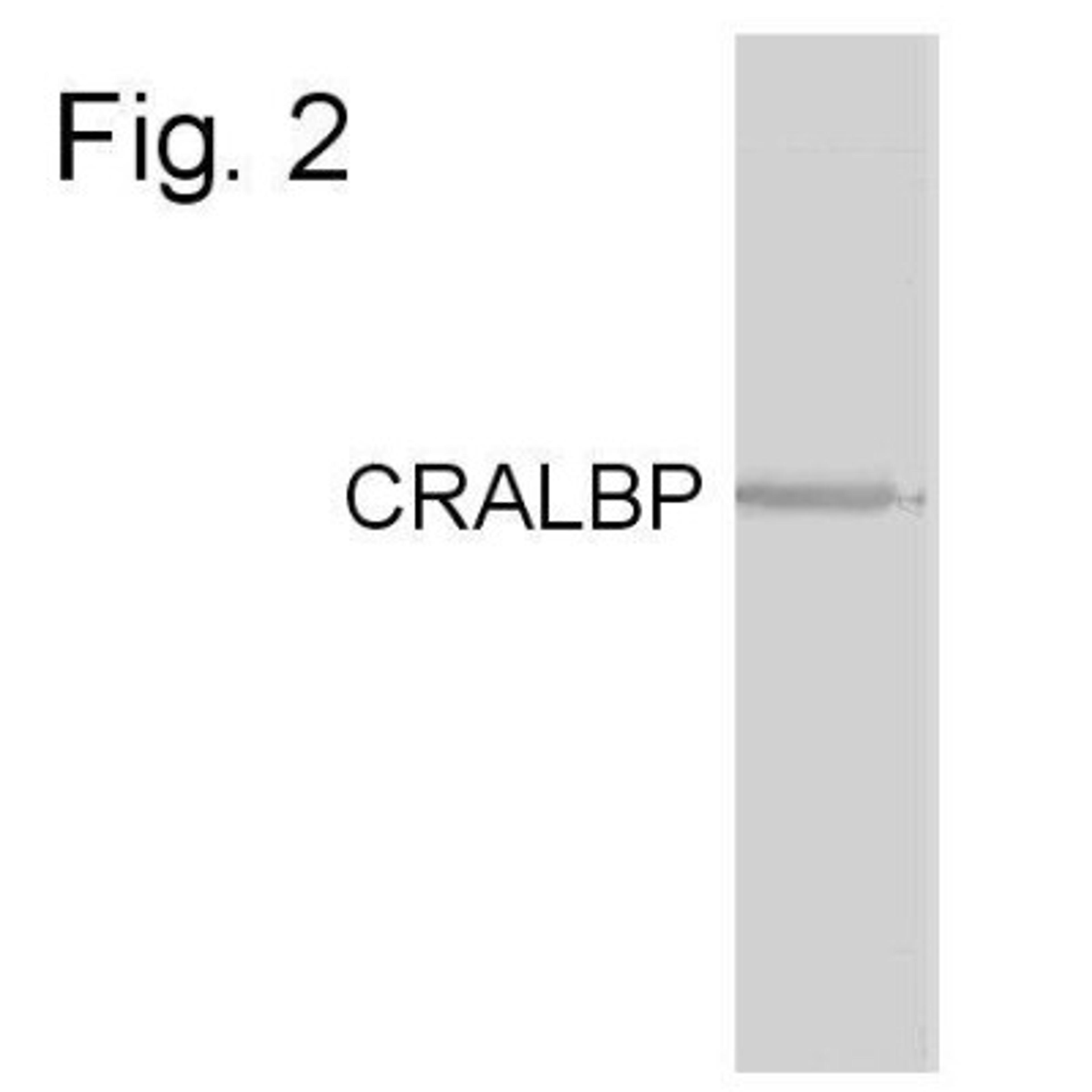 Western Blot: CRALBP Antibody (B2) [NB100-74392] - Analysis of CRALBP antibody on human cell.