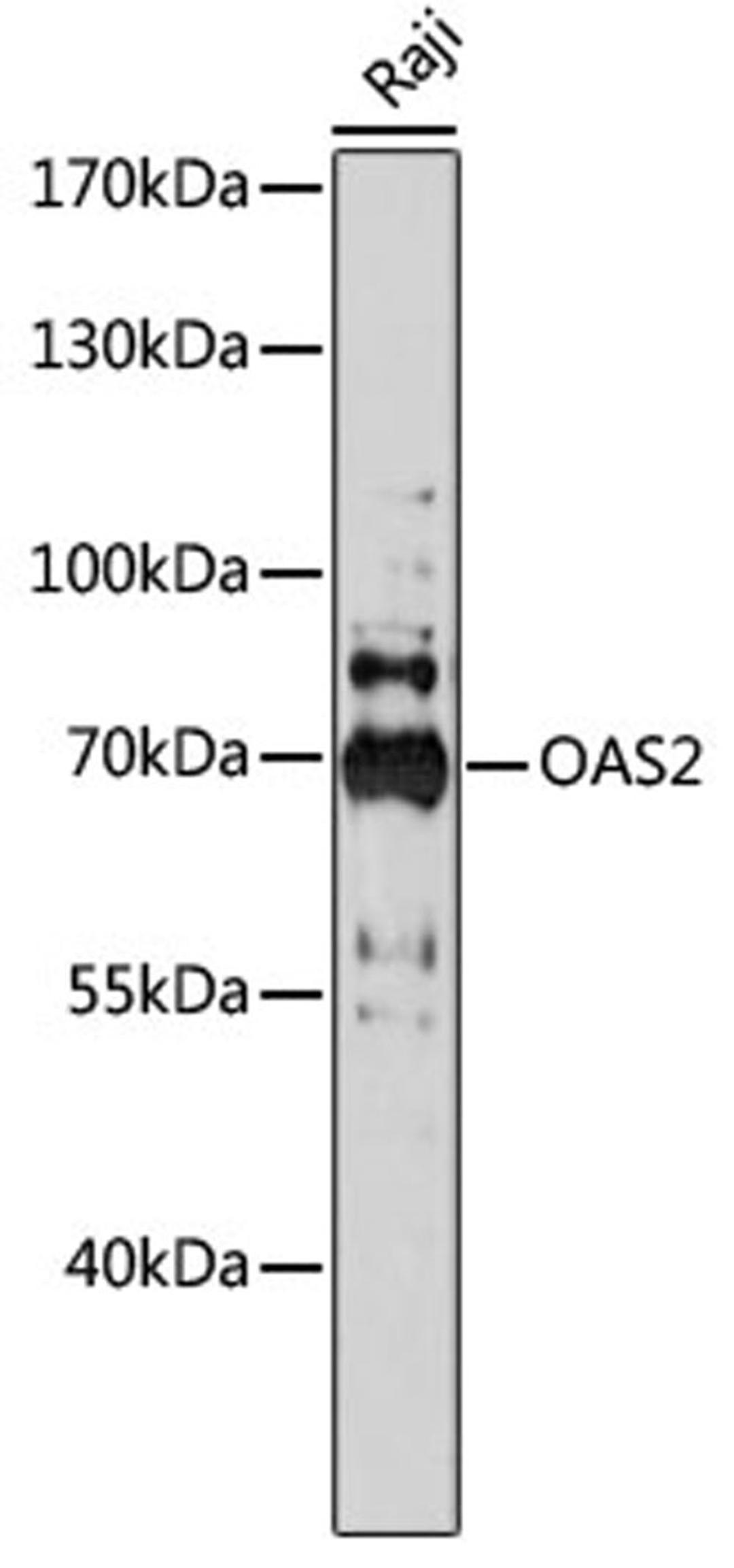 Western blot - OAS2 antibody (A17428)