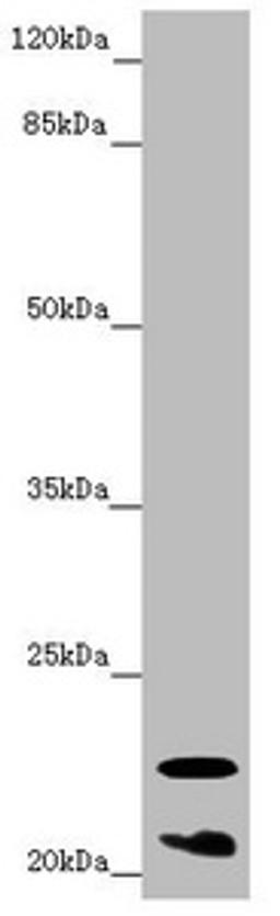 Western blot. All lanes: CRYGS antibody at 6.87 ug/ml + Mouse eye tissue. Secondary. Goat polyclonal to rabbit IgG at 1/10000 dilution. Predicted band size: 21 kDa. Observed band size: 21, 23 kDa. 