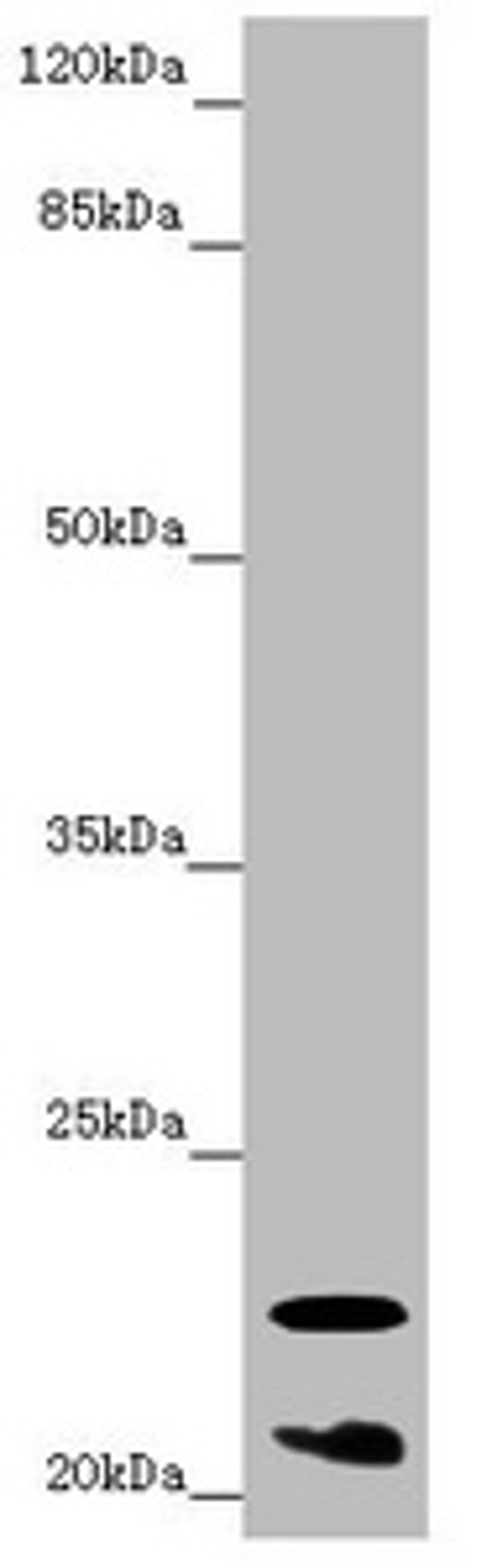 Western blot. All lanes: CRYGS antibody at 6.87 ug/ml + Mouse eye tissue. Secondary. Goat polyclonal to rabbit IgG at 1/10000 dilution. Predicted band size: 21 kDa. Observed band size: 21, 23 kDa. 