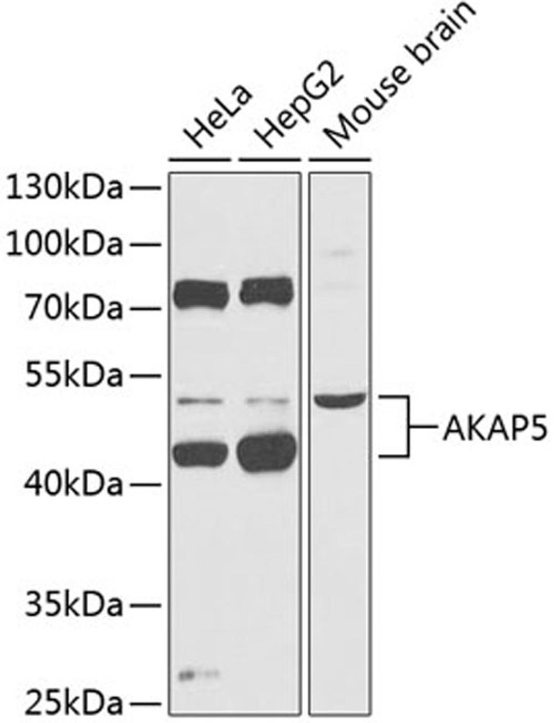 Western blot - AKAP5 Antibody (A14091)