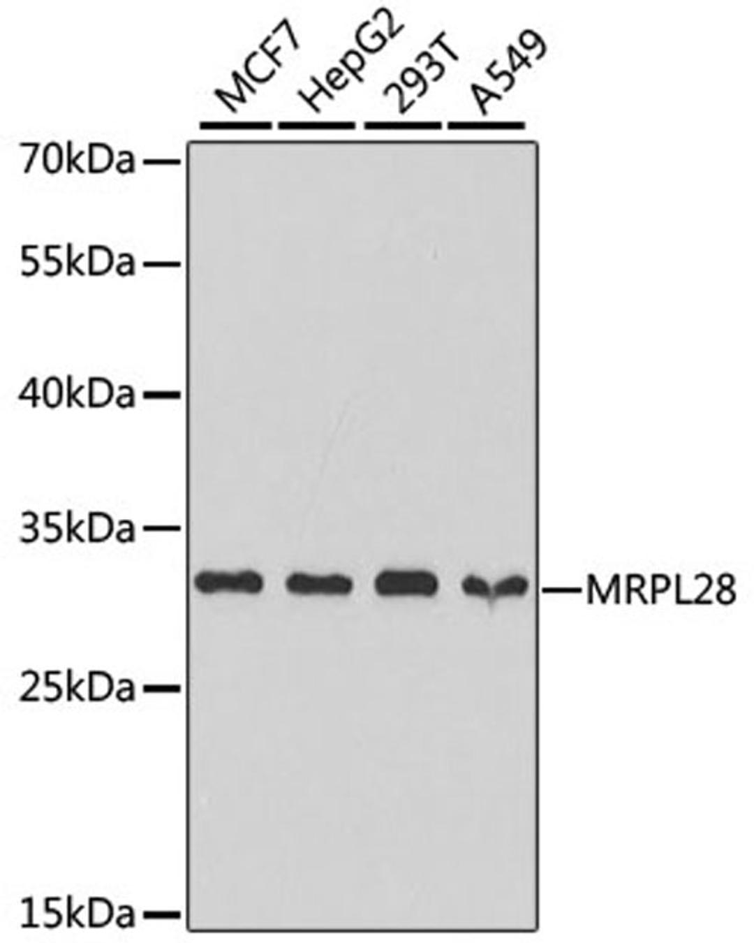 Western blot - MRPL28 antibody (A5897)