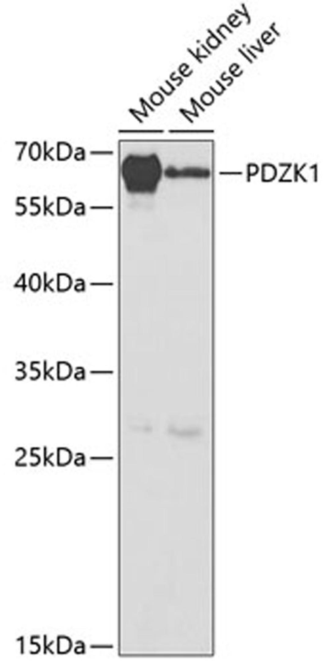 Western blot - PDZK1 antibody (A5321)