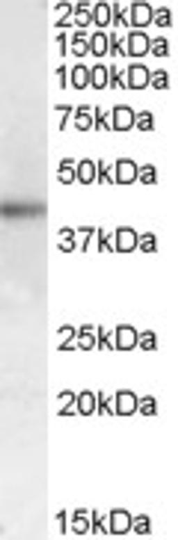 45-870 (1ug/ml) staining of Human Skin lysate (35ug protein in RIPA buffer). Primary incubation was 1 hour. Detected by chemiluminescence.