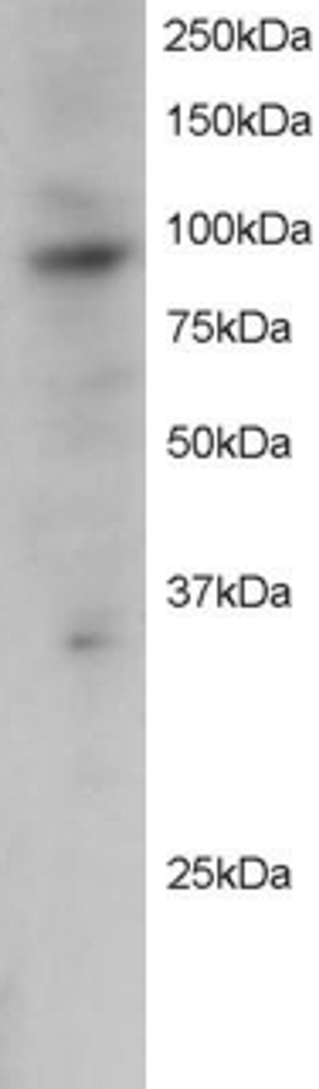 46-214 staining (2ug/ml) of Jurkat lysate (RIPA buffer, 30ug total protein per lane). Primary incubated for 12 hour. Detected by western blot using chemiluminescence.